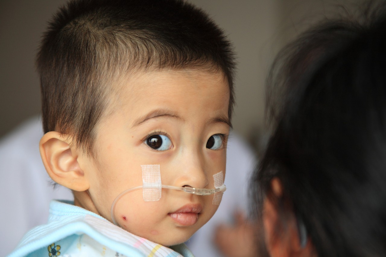 Healthy child after receiving a congenital heart disease corrective surgery.