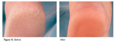 sole solution sole solution